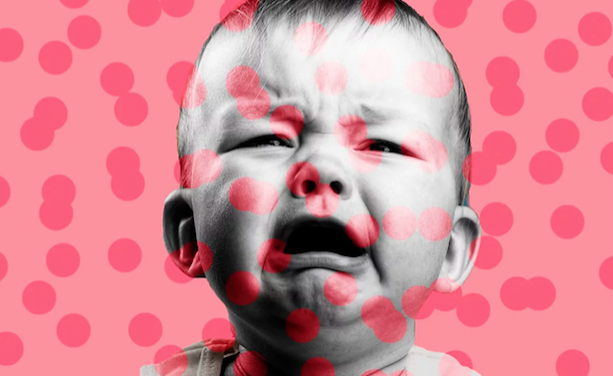 Recrudescence de la rougeole : 146 cas recensés en Auvergne-Rhône-Alpes depuis le début de l&rsquo;année