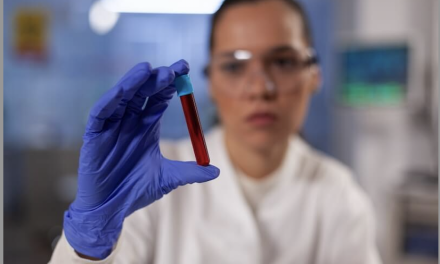 Vienne Condrieu Agglomération-En vue du procès à venir, 500 habitants tirés au sort pour une étude d’imprégnation sur les PFAS